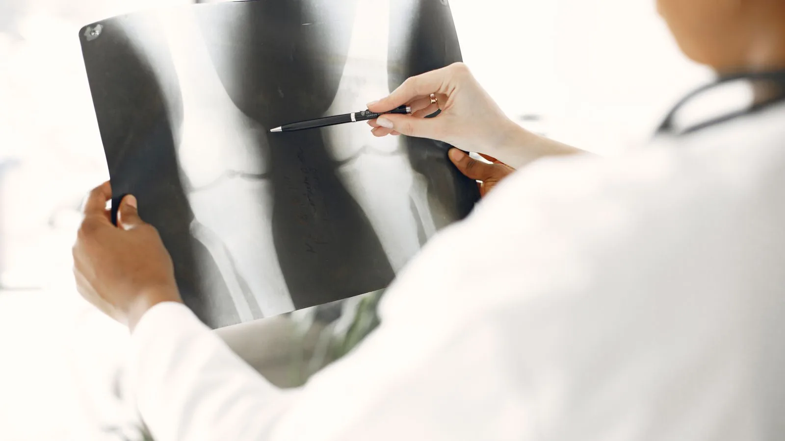 Profissional de saúde apontando detalhes em uma radiografia de perna